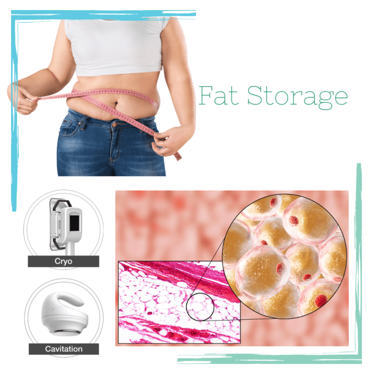 Fat Cells and Fat Storage: Explanation & Fat Burning Tips