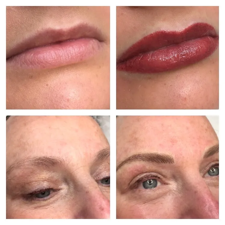 Aesthetics Clinic In Bolton