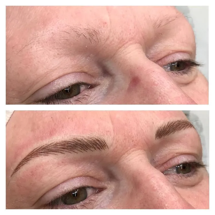 Overplucked and sparse eyebrows