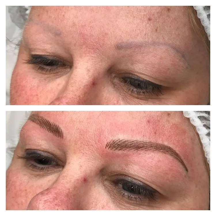 Overplucked and sparse Eyebrows