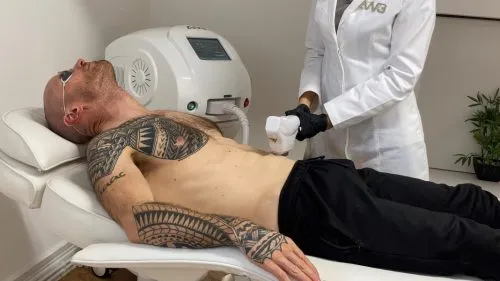 Laser Hair Removal vs. Waxing