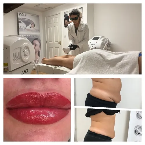 Aesthetics Treatments