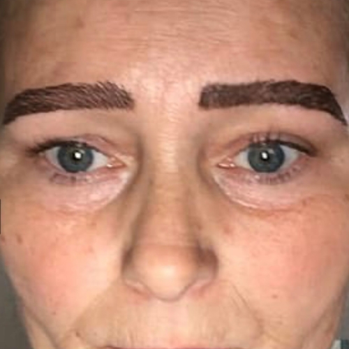 Microblading Removal: What You Need to Know