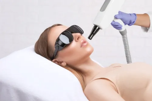 Laser Pigmentation Removal: Clearer Skin & Confidence