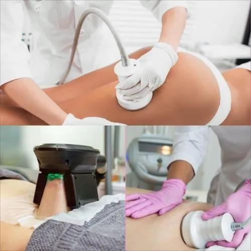 Non-Invasive Body Contouring