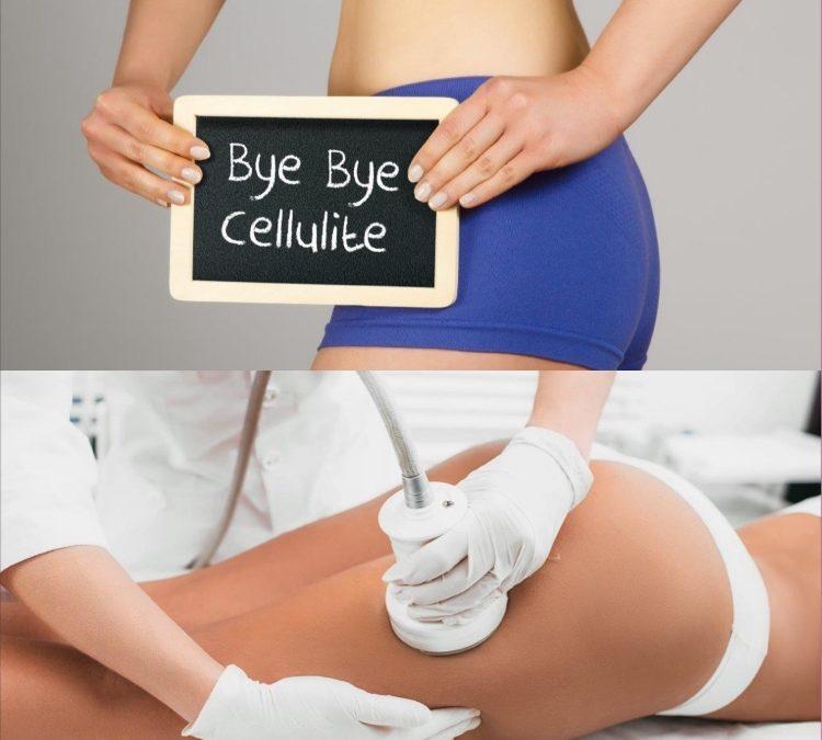Body Contouring and Cellulite Reduction: Non-Invasive Treatments