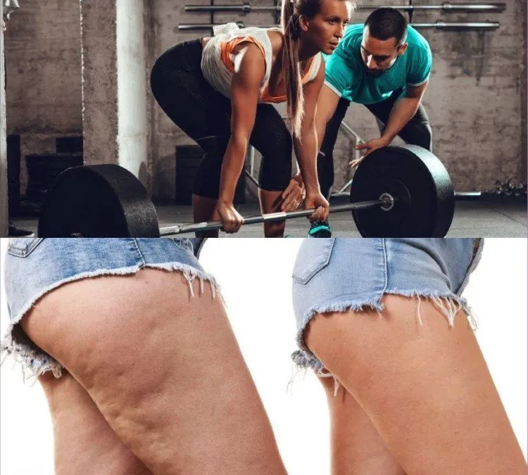 Exercise for Cellulite Reduction: Your Guide To Smoother Skin