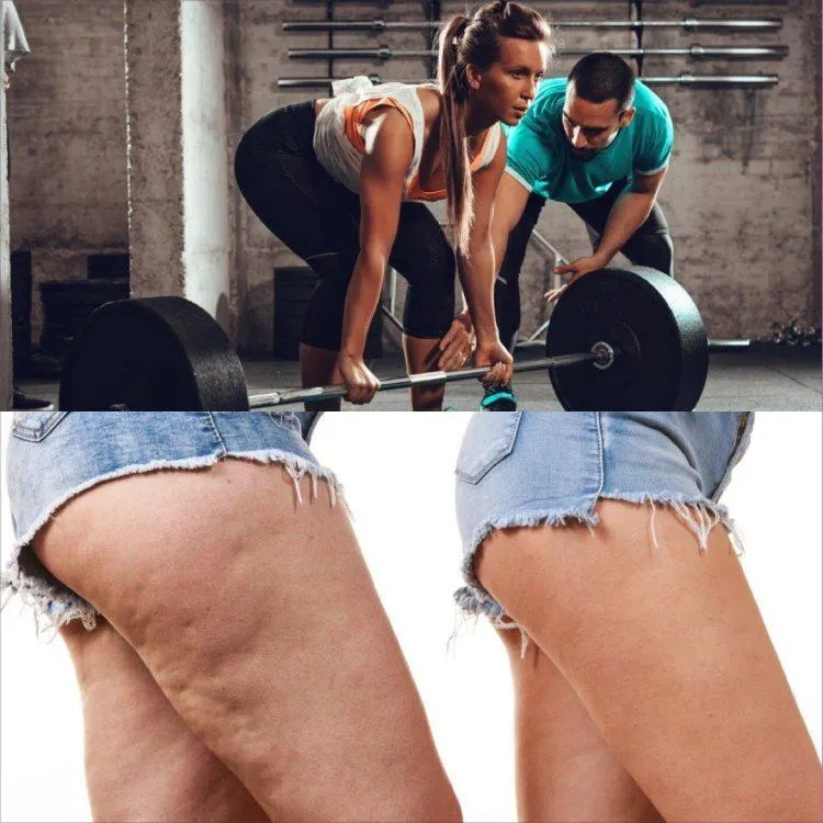 Exercise For Celluite Reduction