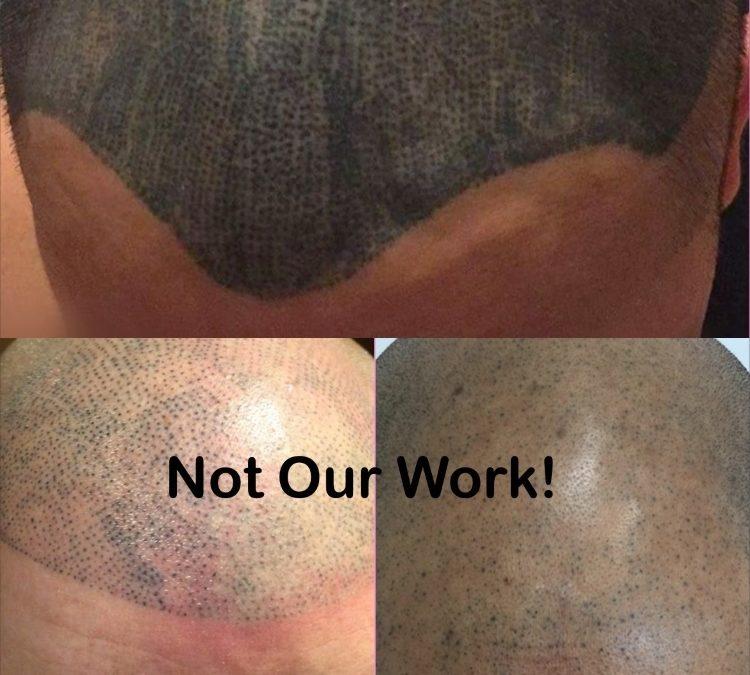Scalp Micropigmentation Regrets: Causes & What To Do About Them