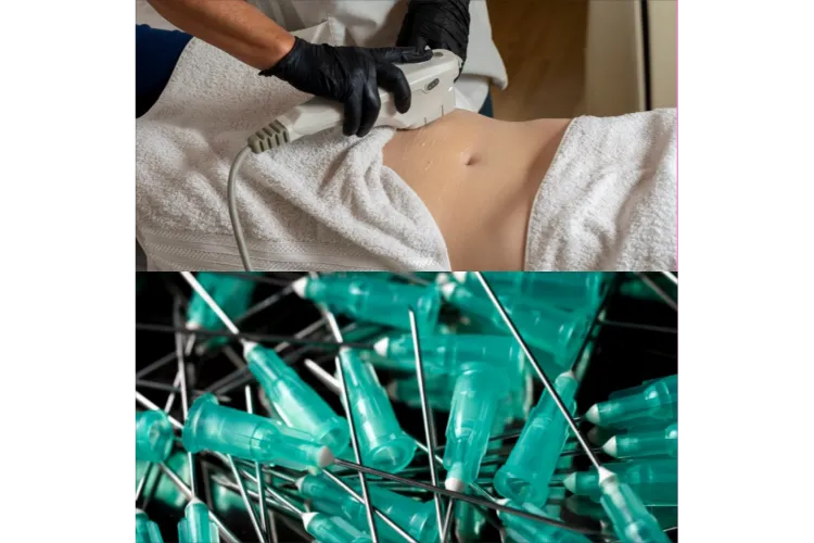 HIFU Fat Reduction v Fat Dissolving Injections