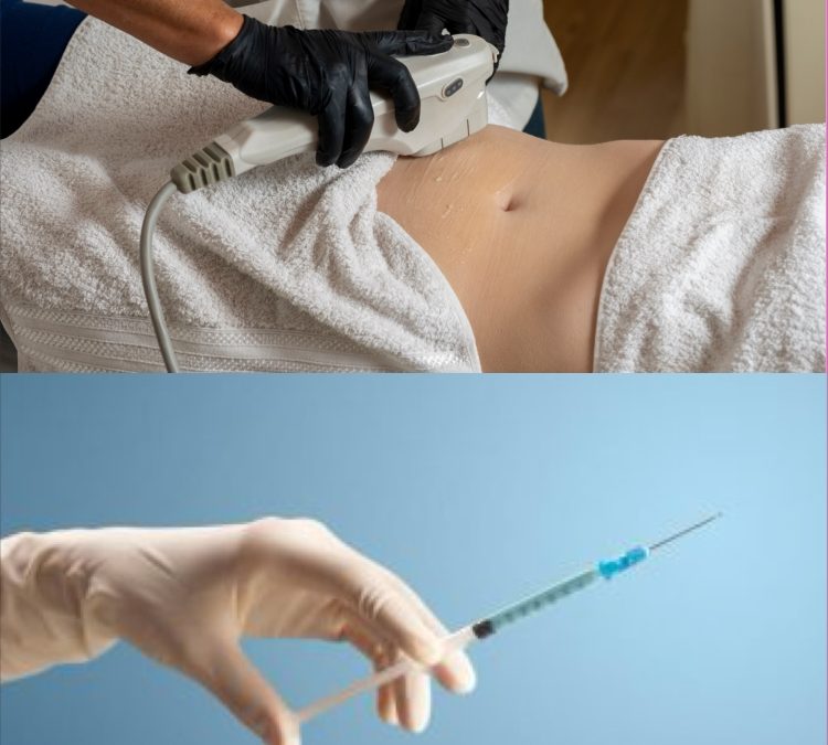HIFU Fat Reduction vs Fat Dissolving Injections