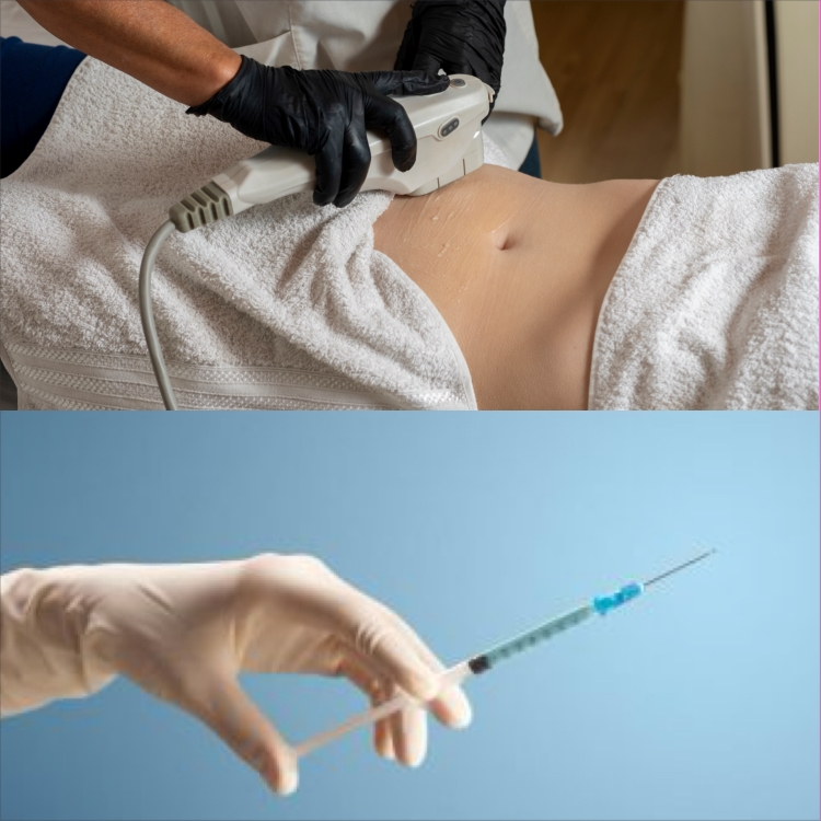 HIFU Fat Reduction vs Fat Dissolving Injections