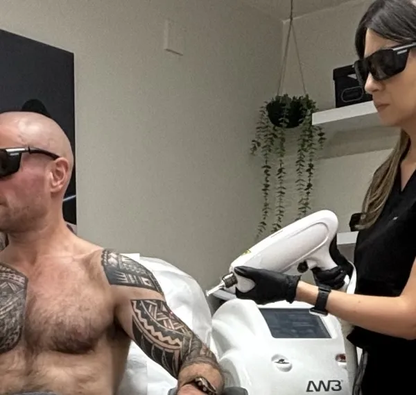 Laser Tattoo Removal Award Winning Artist