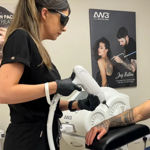 Laser Tattoo Removal for Scalp Micropigmentation: Expert Tips