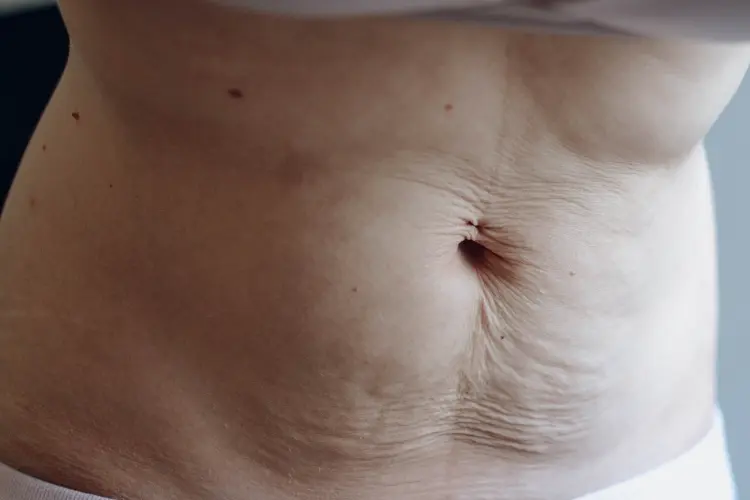 Mummy Tummy Treatment