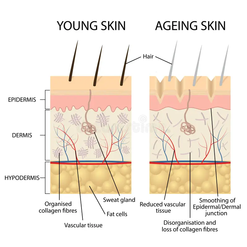 wrinkle treatment explanation