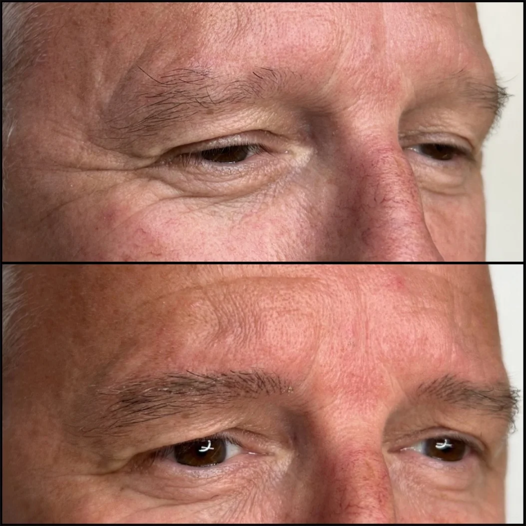 Male Microblading clinic serving Lancashire