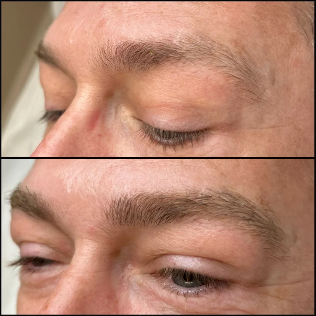 Eyebrow tattoo for men in Lancashire before and after results