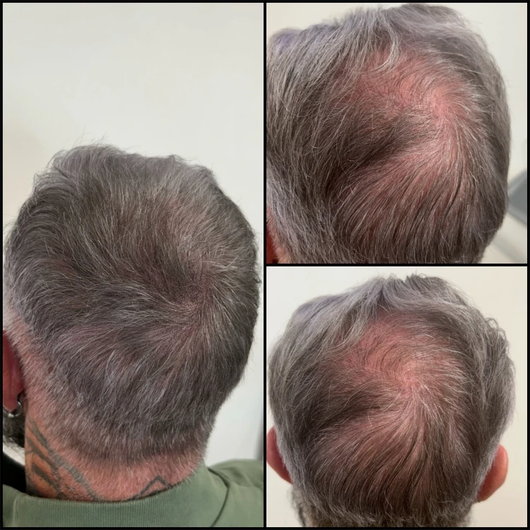 Result showing natural blending through existing