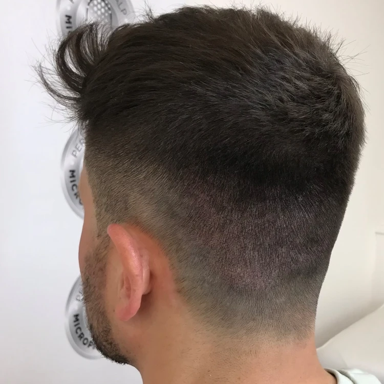 SMP scars camouflage for hair transplant scars to support shaved fade hair styles