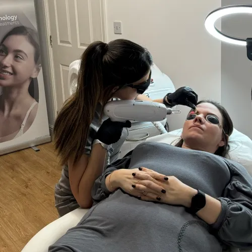Laser Eyebrow Tattoo Removal