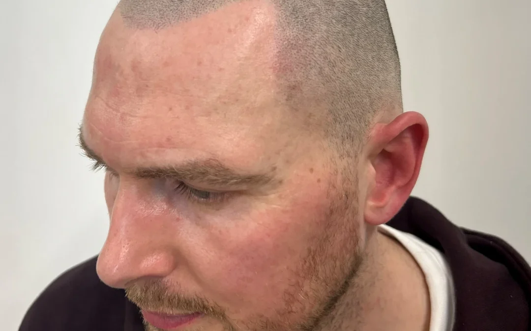 Hair Tattoo in Lancashire