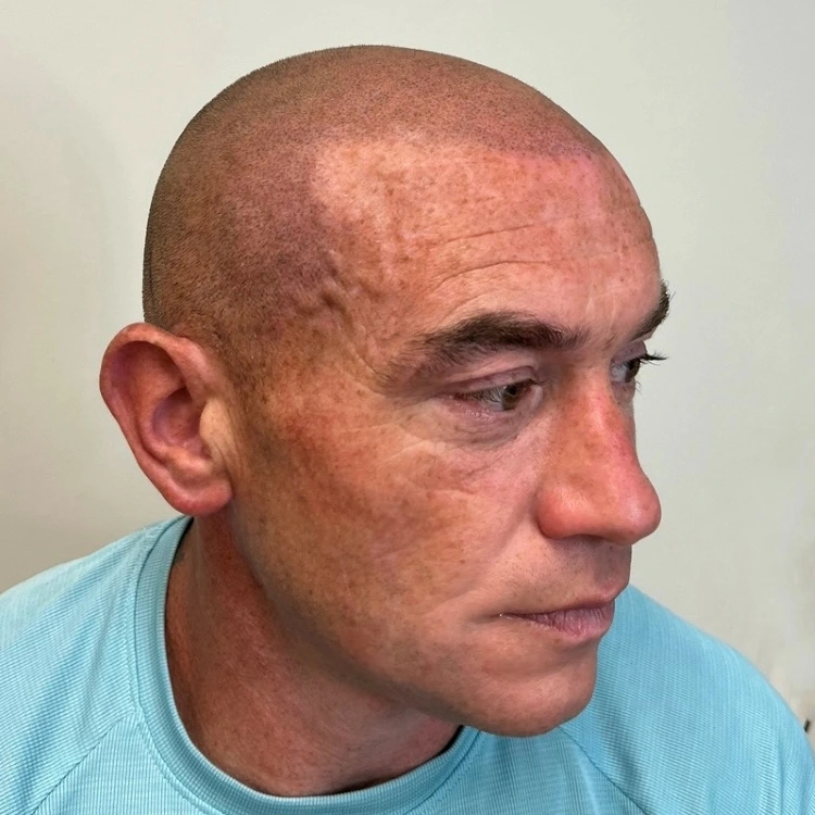 Hair Tattoo In Bolton