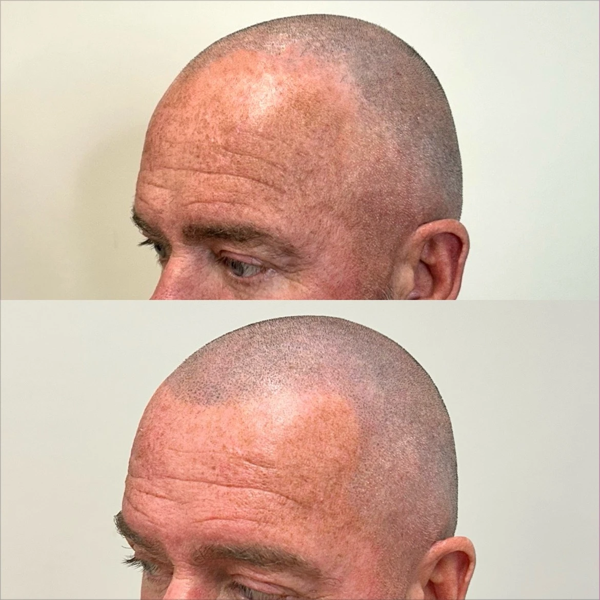 Hair Tattoo in Southport