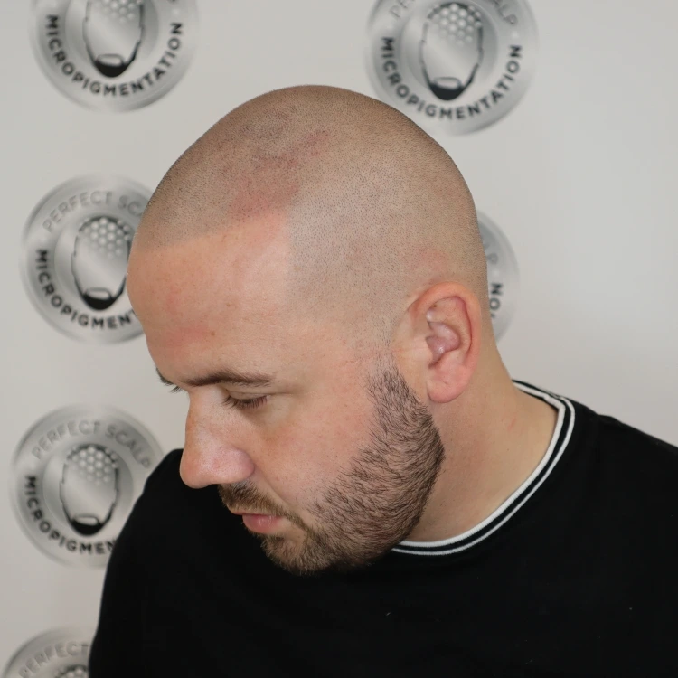 Hair Tattoo in Ormskirk